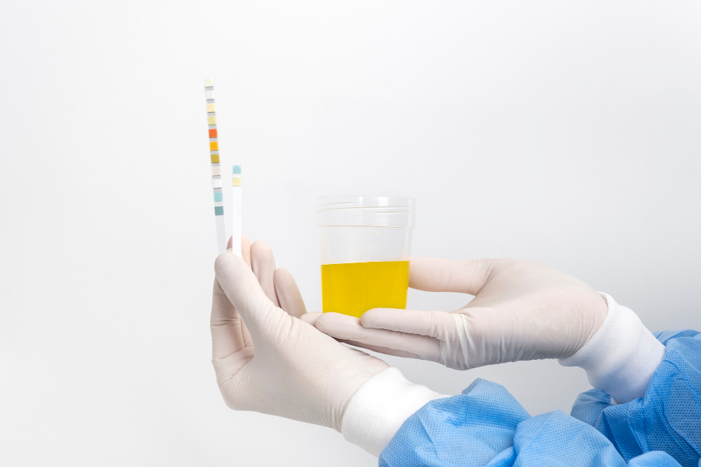 Early Kidney Dysfunction: What Quantitative Urine Testing Can Reveal