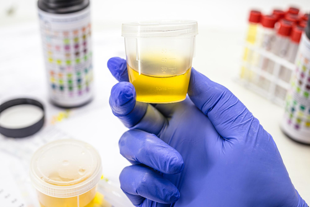 Understanding Creatinine Normalization In Urinary Biomarker Analysis