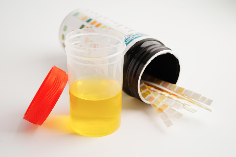 when-quantitative-urinalysis-provides-more-insight-than-blood-testing