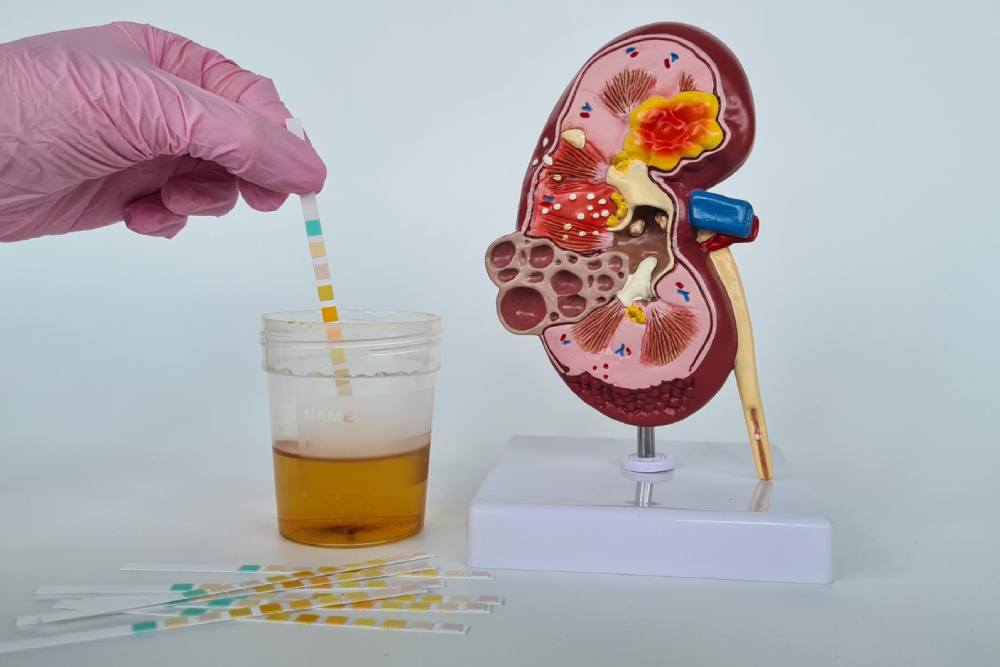 Designing Clear And Actionable Quantitative Urinalysis Reports For Clinicians
