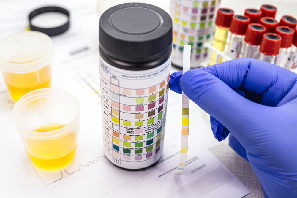 Improving Reproducibility In Quantitative Urine Testing Across Batches