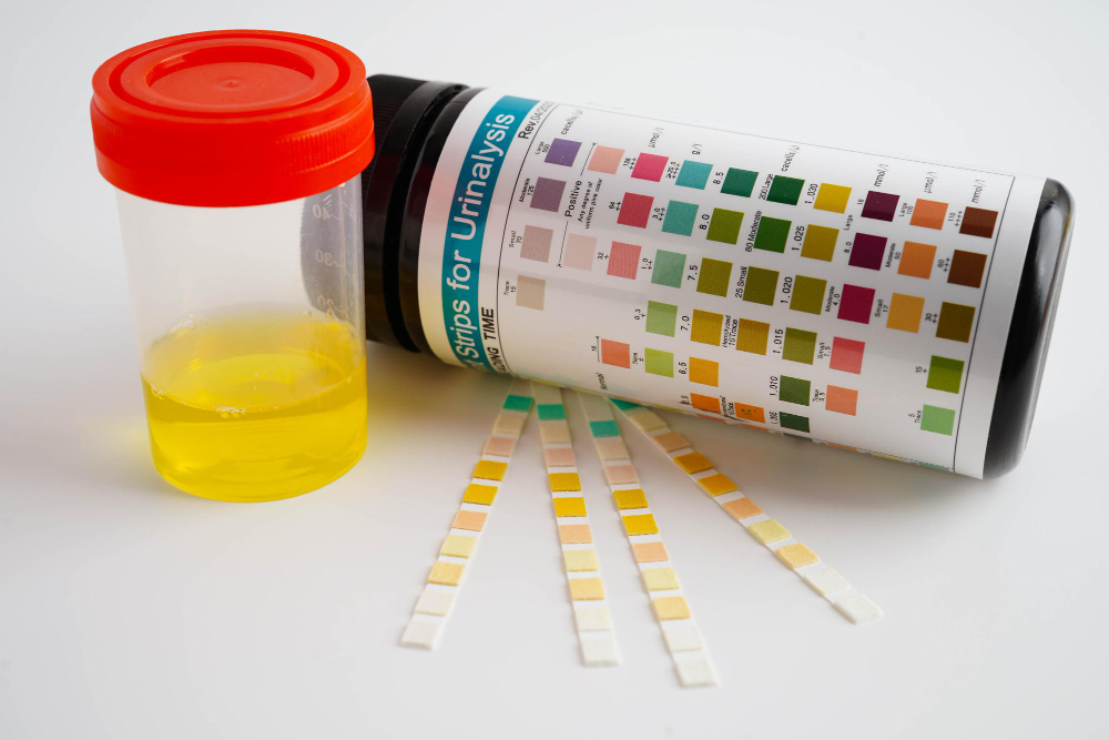 Scaling Quantitative Urinalysis: Automation, Throughput, And Cost Considerations