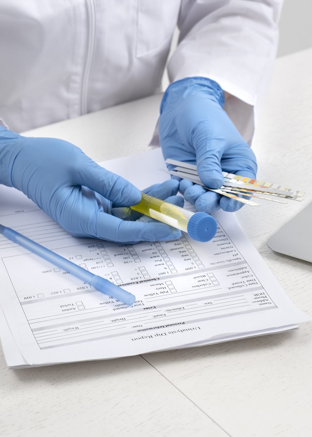 lab-doctor-performing-medical-exam-urine