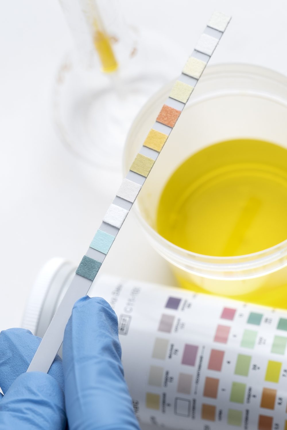 lab-doctor-performing-medical-exam-urine
